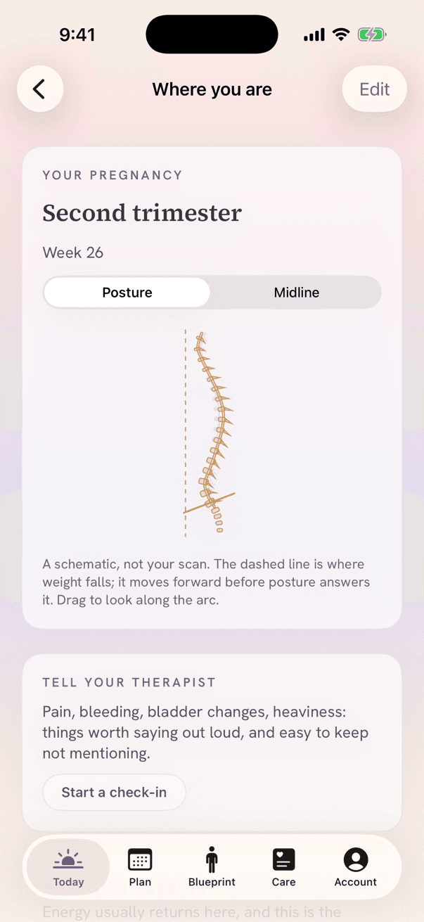 Second trimester, week 26, posture schematic